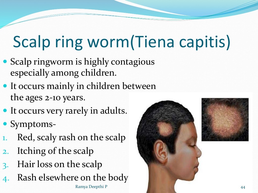 Disorders of skin in children