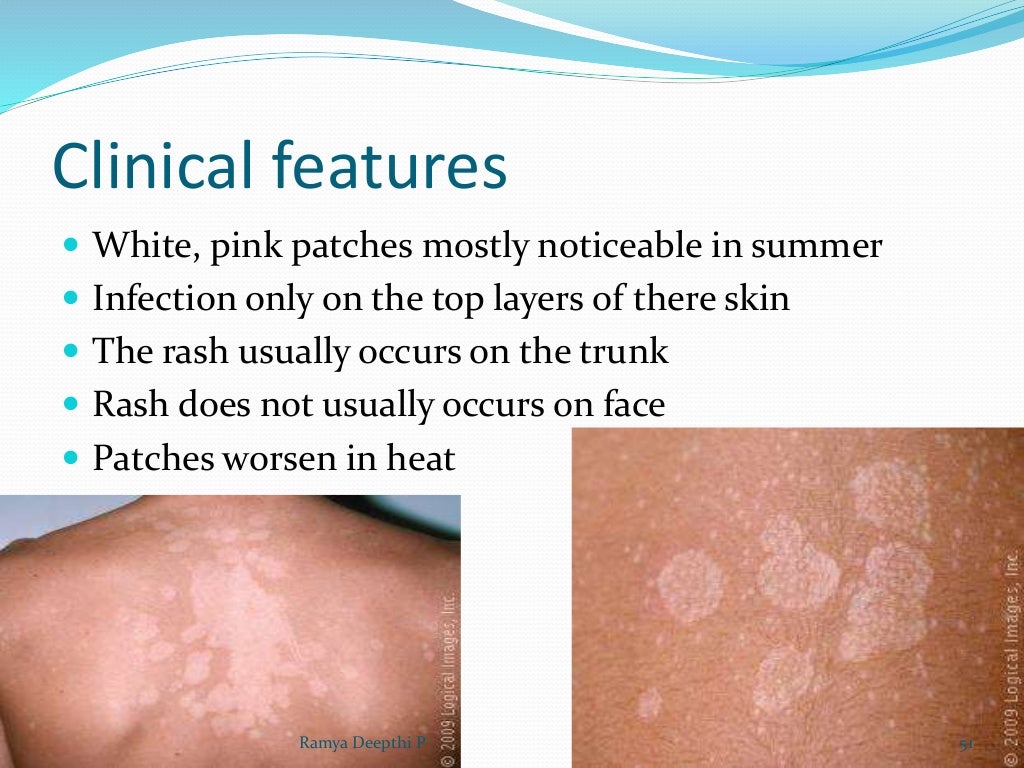 Disorders of skin in children