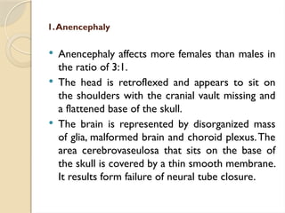 1.Anencephaly
 Anencephaly affects more females than males in
the ratio of 3:1.
 The head is retroflexed and appears to sit on
the shoulders with the cranial vault missing and
a flattened base of the skull.
 The brain is represented by disorganized mass
of glia, malformed brain and choroid plexus.The
area cerebrovaseulosa that sits on the base of
the skull is covered by a thin smooth membrane.
It results form failure of neural tube closure.
 