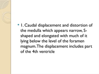  1. Caudal displacement and distortion of
the medulla which appears narrow, S-
shaped and elongated with much of it
lying below the level of the foramen
magnum.The displacement includes part
of the 4th ventricle
 