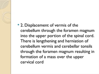  2. Displacement of vermis of the
cerebellum through the foramen magnum
into the upper portion of the spinal cord.
There is lengthening and herniation of
cerebellum vermis and cerebellar tonsils
through the foramen magnum resulting in
formation of a mass over the upper
cervical cord
 