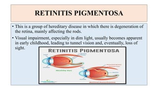 Disorders of the eye | PPTX