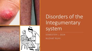 Disorders of the
Integumentary
system
SEMESTER I, 2024
NUZHAT RUHI
 