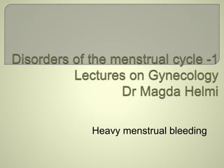 Heavy menstrual bleeding 
 