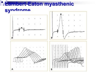 Lambert Muscle Disorders of the neuromuscular junction | PPTX