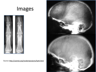 Images
Source: http://uwmsk.org/residentprojects/hpth.html
 