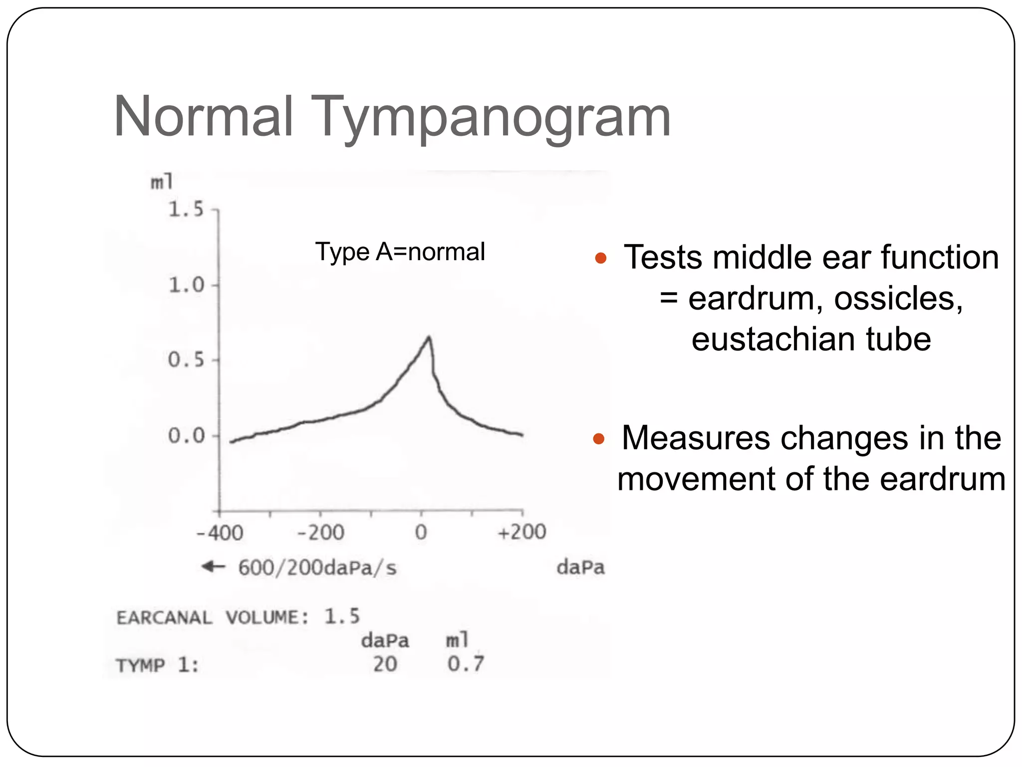 Normal Tympanogram
 Tests middle ear function
= eardrum, ossicles,
eustachian tube
 Measures changes in the
movement of the eardrum
Type A=normal
 