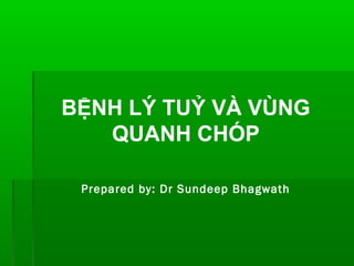 BỆNH LÝ TUỶ VÀ VÙNG
   QUANH CHÓP

 Prepared by: Dr Sundeep Bhagwath
 