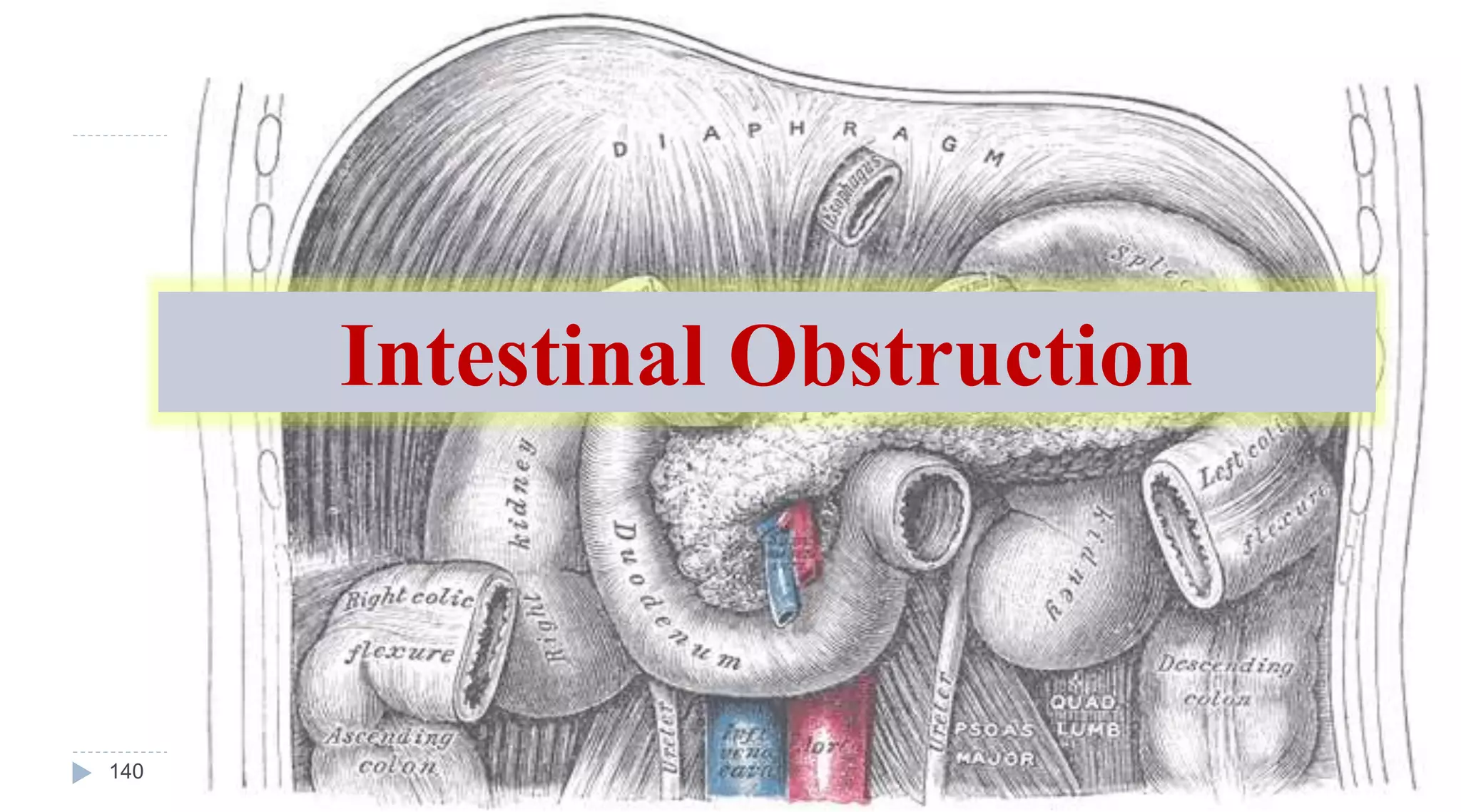 Intestinal Obstruction
140
 