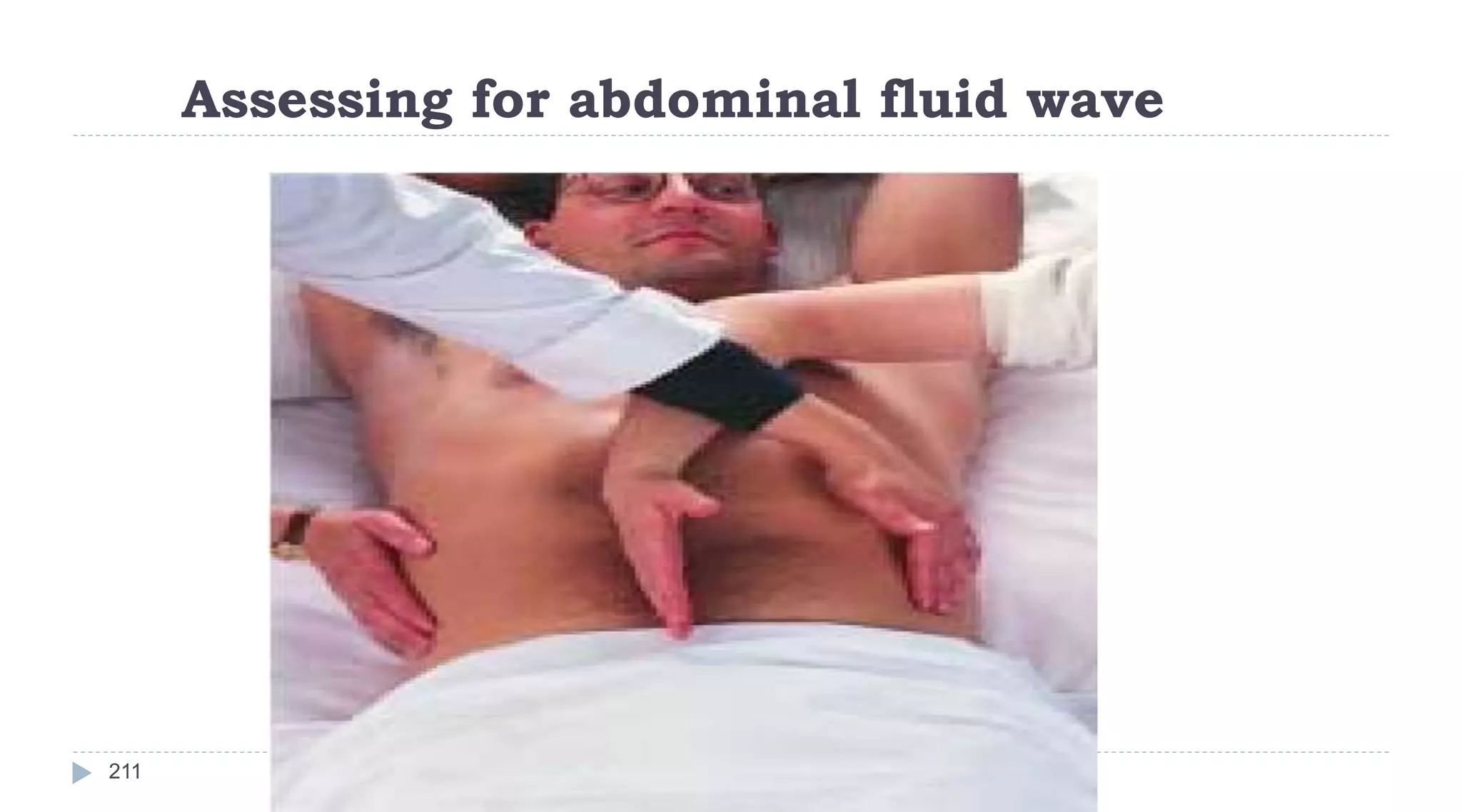 Assessing for abdominal fluid wave
211
 