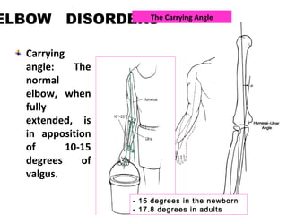ELBOW DISORDERS
Carrying
angle: The
normal
elbow, when
fully
extended, is
in apposition
of 10-15
degrees of
valgus.
The Carrying Angle
- 15 degrees in the newborn
- 17.8 degrees in adults
 