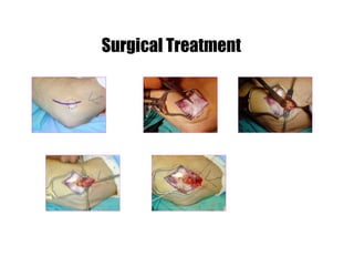 Surgical Treatment
 