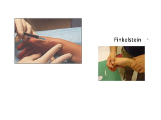 •
Finkelstein
 