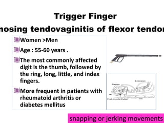 Women >Men
Age : 55-60 years .
The most commonly affected
digit is the thumb, followed by
the ring, long, little, and index
fingers.
More frequent in patients with
rheumatoid arthritis or
diabetes mellitus
Trigger Finger
nosing tendovaginitis of flexor tendon
snapping or jerking movements
 