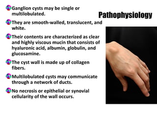 Ganglion cysts may be single or
multilobulated.
They are smooth-walled, translucent, and
white.
Their contents are characterized as clear
and highly viscous mucin that consists of
hyaluronic acid, albumin, globulin, and
glucosamine.
The cyst wall is made up of collagen
fibers.
Multilobulated cysts may communicate
through a network of ducts.
No necrosis or epithelial or synovial
cellularity of the wall occurs.
Pathophysiology
 