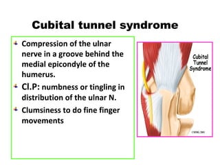 Compression of the ulnar
nerve in a groove behind the
medial epicondyle of the
humerus.
Cl.P: numbness or tingling in
distribution of the ulnar N.
Clumsiness to do fine finger
movements
Cubital tunnel syndrome
 