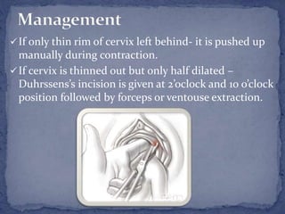 Disorders of uterine contraction, precipitate labor, premature labor ...