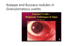 Diseases and DISORDERSOF UVEAL TRACT 1.ppt