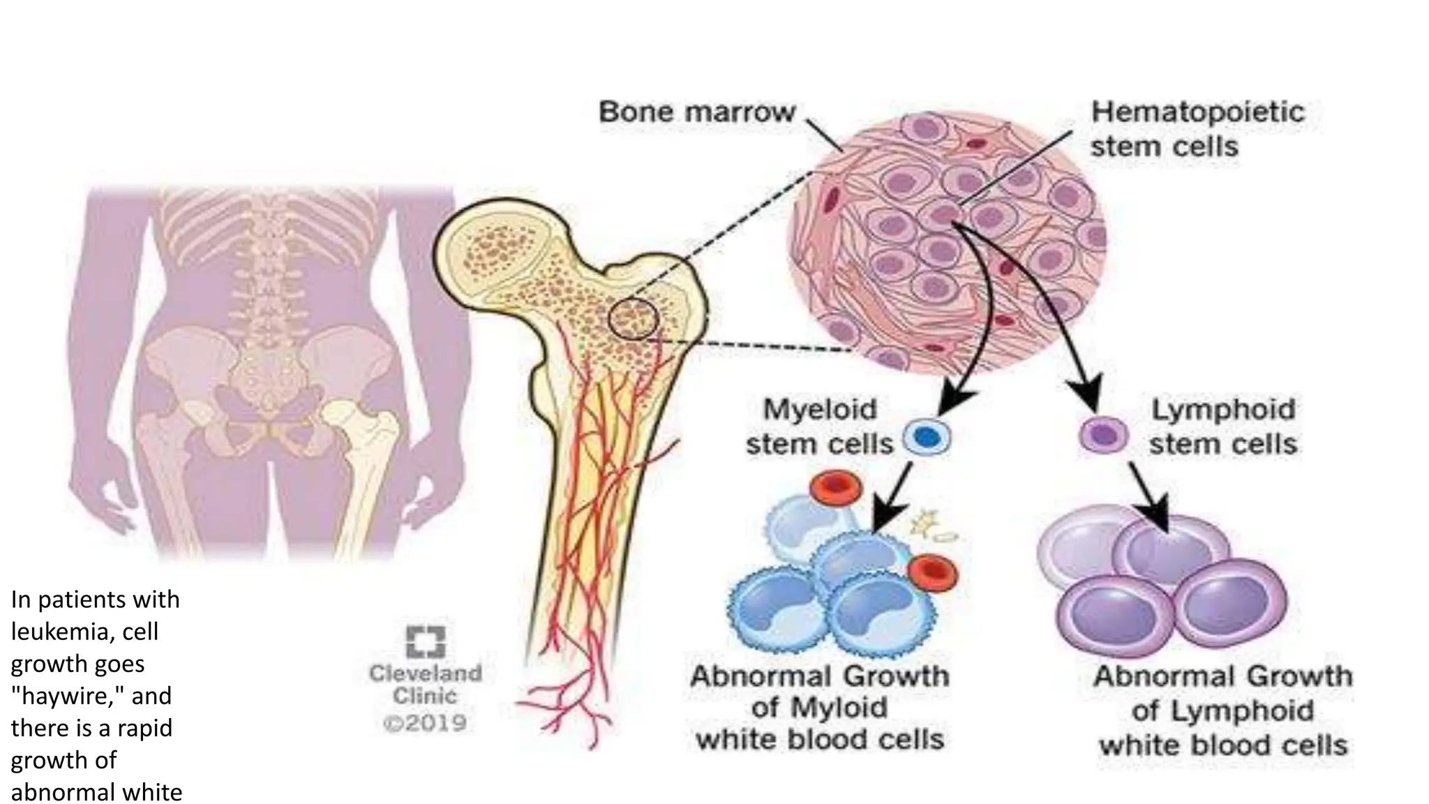 Disorders of white blood cells and related conditions | PPTX