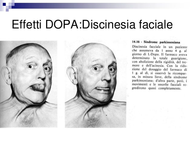 Metodi di cura dimpotenza chirurgica