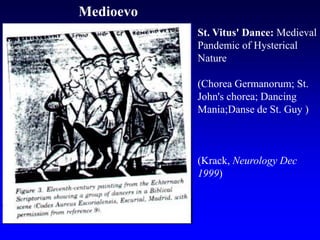 St. Vitus' Dance: Medieval
Pandemic of Hysterical
Nature
(Chorea Germanorum; St.
John's chorea; Dancing
Mania;Danse de St. Guy )
(Krack, Neurology Dec
1999)
Medioevo
 