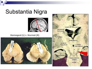 Substantia Nigra
 