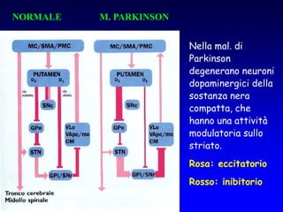 NORMALE M. PARKINSON
Nella mal. di
Parkinson
degenerano neuroni
dopaminergici della
sostanza nera
compatta, che
hanno una attività
modulatoria sullo
striato.
Rosa: eccitatorio
Rosso: inibitorio
 
