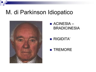 M. di Parkinson Idiopatico
 ACINESIA –
BRADICINESIA
 RIGIDITA’
 TREMORE
 