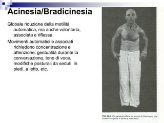 Acinesia/Bradicinesia
Globale riduzione della motilità
automatica, ma anche volontaria,
associata e riflessa.
Movimenti automatici e associati
richiedono concentrazione e
attenzione: gestualità durante la
conversazione, tono di voce,
modifiche posturali da seduti, in
piedi, a letto, etc.
 