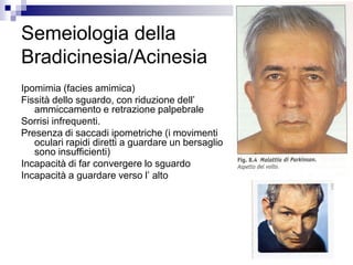 Semeiologia della
Bradicinesia/Acinesia
Ipomimia (facies amimica)
Fissità dello sguardo, con riduzione dell’
ammiccamento e retrazione palpebrale
Sorrisi infrequenti.
Presenza di saccadi ipometriche (i movimenti
oculari rapidi diretti a guardare un bersaglio
sono insufficienti)
Incapacità di far convergere lo sguardo
Incapacità a guardare verso l’ alto
 
