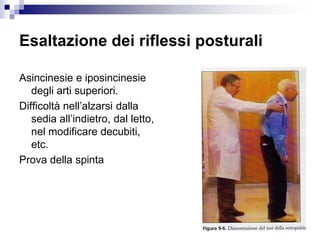 Esaltazione dei riflessi posturali
Asincinesie e iposincinesie
degli arti superiori.
Difficoltà nell’alzarsi dalla
sedia all’indietro, dal letto,
nel modificare decubiti,
etc.
Prova della spinta
 