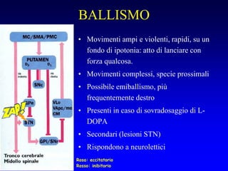 BALLISMO
• Movimenti ampi e violenti, rapidi, su un
fondo di ipotonia: atto di lanciare con
forza qualcosa.
• Movimenti complessi, specie prossimali
• Possibile emiballismo, più
frequentemente destro
• Presenti in caso di sovradosaggio di L-
DOPA
• Secondari (lesioni STN)
• Rispondono a neurolettici
Rosa: eccitatorio
Rosso: inibitorio
 