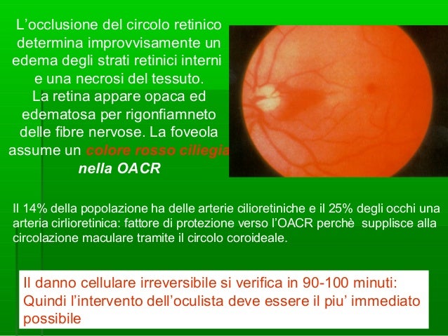 Le medicine che trattano varicosity