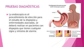 PRUEBAS DIAGNÓSTICAS
 La endoscopia es el
procedimiento de elección para
el estudio de la dispepsia y
enfermedades asociadas, se
deberá realizar en pacientes con
dispepsia que tienen cualquier
signo y síntoma de alarma
 