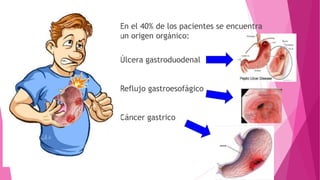 En el 40% de los pacientes se encuentra
un origen orgánico:
Úlcera gastroduodenal
Reflujo gastroesofágico
Cáncer gastrico
 
