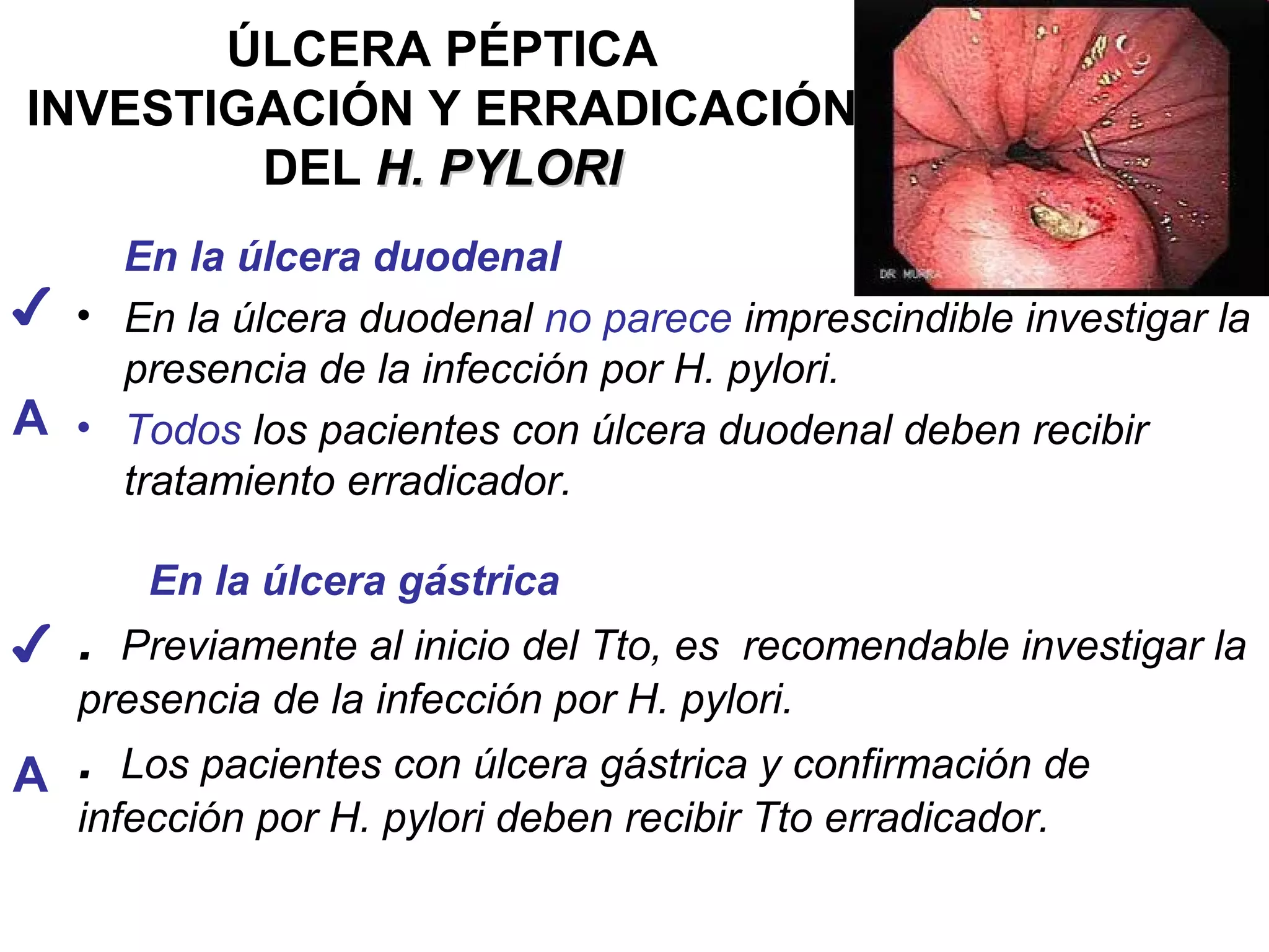 ÚLCERA PÉPTICA
INVESTIGACIÓN Y ERRADICACIÓN
        DEL H. PYLORI
    En la úlcera duodenal
✔ • En la úlcera duodenal no parece imprescindible investigar la
    presencia de la infección por H. pylori.
A • Todos los pacientes con úlcera duodenal deben recibir
    tratamiento erradicador.

       En la úlcera gástrica
✔ . Previamente al inicio del Tto, es recomendable investigar la
   presencia de la infección por H. pylori.
A . Los pacientes con úlcera gástrica y confirmación de
   infección por H. pylori deben recibir Tto erradicador.
 