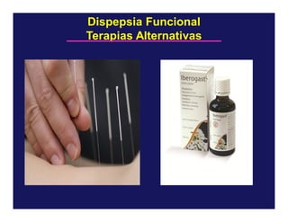 Dispepsia Funcional
Terapias Alternativas

 