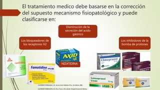 El tratamiento medico debe basarse en la corrección
del supuesto mecanismo fisiopatológico y puede
clasificarse en:
Disminución de la
secreción del acido
gástrico
Los inhibidores de la
bomba de protones
Los bloqueadores de
los receptores H2
NIZATIDINA
GASTROENTEROLOGÍA. Dr. José de Jesús Villalobos Pérez. 5ta edición, 2006.
GASTROENTEROLOGÍA. Dr. Pérez-Torres. 1Era edición. Hospital General de México.
 