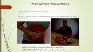 Manifestaciones clínicas comunes.
● Dolor o molestia en la parte superior del abdomen.
● Náuseas.
● Plenitud o saciedad posprandial inmediata y mediata, precoz, con la ingesta de alimentos ( grasas/
carbohidratos).
GASTROENTEROLOGÍA. Dr. José de Jesús Villalobos Pérez. 5ta edición, 2006.
GASTROENTEROLOGÍA. Dr. Pérez-Torres. 1Era edición. Hospital General de México.
 