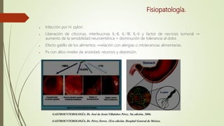 Fisiopatología.
● Infección por H. pylori.
● Liberación de citocinas, interleucinas IL-8, IL-1B, IL-6 y factor de necrosis tumoral →
aumento de la sensibilidad neuroentérica = disminución de tolerancia al dolor.
● Efecto gatillo de los alimentos →relación con alergias o intolerancias alimentarias.
● Px con altos niveles de ansiedad, neurosis y depresión.
GASTROENTEROLOGÍA. Dr. José de Jesús Villalobos Pérez. 5ta edición, 2006.
GASTROENTEROLOGÍA. Dr. Pérez-Torres. 1Era edición. Hospital General de México.
 