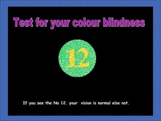 If you see the No 12. your vision is normal else not.
 