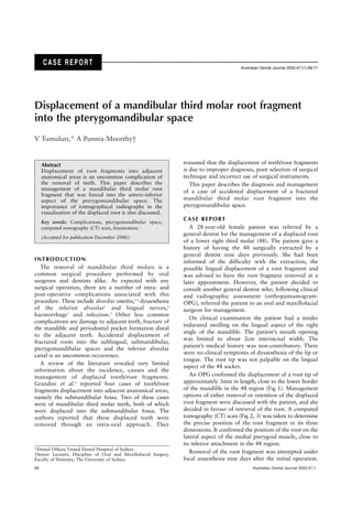 68 Australian Dental Journal 2002;47:1.
Displacement of a mandibular third molar root fragment
into the pterygomandibular space
V Tumuluri,* A Punnia-Moorthy†
Abstract
Displacement of root fragments into adjacent
anatomical areas is an uncommon complication of
the removal of teeth. This paper describes the
management of a mandibular third molar root
fragment that was forced into the antero-inferior
aspect of the pterygomandibular space. The
importance of tomographical radiographs in the
visualization of the displaced root is also discussed.
Key words: Complications, pterygomandibular space,
computed tomography (CT) scan, fenestration.
(Accepted for publication December 2000.)
reasoned that the displacement of teeth/root fragments
is due to improper diagnosis, poor selection of surgical
technique and incorrect use of surgical instruments.
This paper describes the diagnosis and management
of a case of accidental displacement of a fractured
mandibular third molar root fragment into the
pterygomandibular space.
CASE REPORT
A 28-year-old female patient was referred by a
general dentist for the management of a displaced root
of a lower right third molar (48). The patient gave a
history of having the 48 surgically extracted by a
general dentist nine days previously. She had been
informed of the difficulty with the extraction, the
possible lingual displacement of a root fragment and
was advised to have the root fragment removed at a
later appointment. However, the patient decided to
consult another general dentist who, following clinical
and radiographic assessment (orthopantamogram-
OPG), referred the patient to an oral and maxillofacial
surgeon for management.
On clinical examination the patient had a tender
indurated swelling on the lingual aspect of the right
angle of the mandible. The patient’s mouth opening
was limited to about 2cm interincisal width. The
patient’s medical history was non-contributory. There
were no clinical symptoms of dysaesthesia of the lip or
tongue. The root tip was not palpable on the lingual
aspect of the 48 socket.
An OPG confirmed the displacement of a root tip of
approximately 3mm in length, close to the lower border
of the mandible in the 48 region (Fig 1). Management
options of either removal or retention of the displaced
root fragment were discussed with the patient, and she
decided in favour of retrieval of the root. A computed
tomography (CT) scan (Fig 2, 3) was taken to determine
the precise position of the root fragment in its three
dimensions. It confirmed the position of the root on the
lateral aspect of the medial pterygoid muscle, close to
its inferior attachment in the 48 region.
Removal of the root fragment was attempted under
local anaesthesia nine days after the initial operation.
*Dental Officer, United Dental Hospital of Sydney.
†Senior Lecturer, Discipline of Oral and Maxillofacial Surgery,
Faculty of Dentistry, The University of Sydney.
CASE REPORT
Australian Dental Journal 2002;47:(1):68-71
INTRODUCTION
The removal of mandibular third molars is a
common surgical procedure performed by oral
surgeons and dentists alike. As expected with any
surgical operation, there are a number of intra- and
post-operative complications associated with this
procedure. These include alveolar osteitis,1-4
dysaesthesia
of the inferior alveolar5
and lingual nerves,6
haemorrhage7
and infection.3
Other less common
complications are damage to adjacent teeth, fracture of
the mandible and periodontal pocket formation distal
to the adjacent teeth. Accidental displacement of
fractured roots into the sublingual, submandibular,
pterygomandibular spaces and the inferior alveolar
canal is an uncommon occurrence.
A review of the literature revealed very limited
information about the incidence, causes and the
management of displaced tooth/root fragments.
Grandini et al.8
reported four cases of tooth/root
fragments displacement into adjacent anatomical areas,
namely the submandibular fossa. Two of these cases
were of mandibular third molar teeth, both of which
were displaced into the submandibular fossa. The
authors reported that these displaced teeth were
removed through an intra-oral approach. They
 