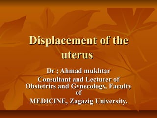 Displacement of theDisplacement of the
uterusuterus
Dr ; Ahmad mukhtarDr ; Ahmad mukhtar
Consultant and Lecturer ofConsultant and Lecturer of
Obstetrics and Gynecology, FacultyObstetrics and Gynecology, Faculty
ofof
MEDICINE, Zagazig University.MEDICINE, Zagazig University.
 