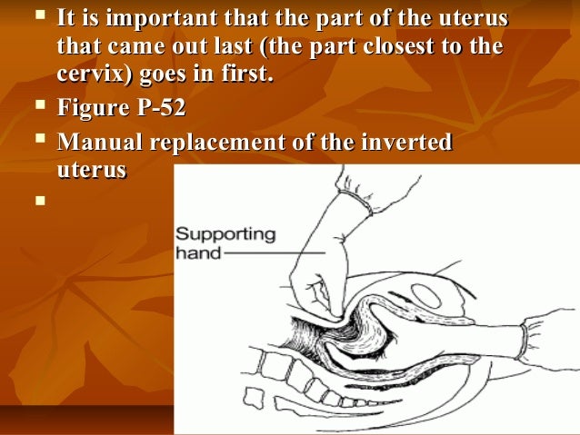Displacement of the uterus