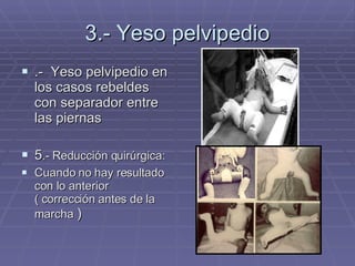 3.- Yeso pelvipedio .-  Yeso pelvipedio en los casos rebeldes con separador entre las piernas 5 .- Reducción quirúrgica:  Cuando no hay resultado con lo anterior ( corrección antes de la marcha  ) 