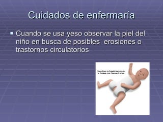 Cuidados de enfermaría Cuando se usa yeso observar la piel del niño en busca de posibles  erosiones o trastornos circulatorios 