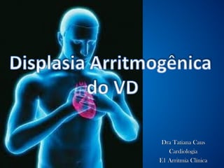 Dra Tatiana CausDra Tatiana Caus
CardiologiaCardiologia
E1 Arritmia ClínicaE1 Arritmia Clínica
 