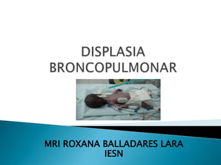 DISPLASIA BRONCOPULMONAR MRI ROXANA BALLADARES LARA IESN 