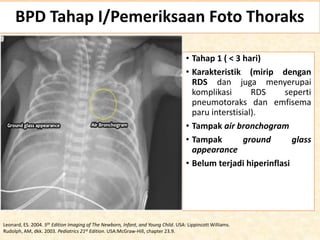 Bpd Rds DISPLASIA_BRONKOPULMONER_FIX1_Perawati.pptx