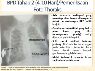 DISPLASIA_BRONKOPULMONER_FIX1_Perawati.pptx